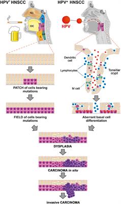 Immunological Network in Head and Neck Squamous Cell Carcinoma—A Prognostic Tool Beyond HPV Status